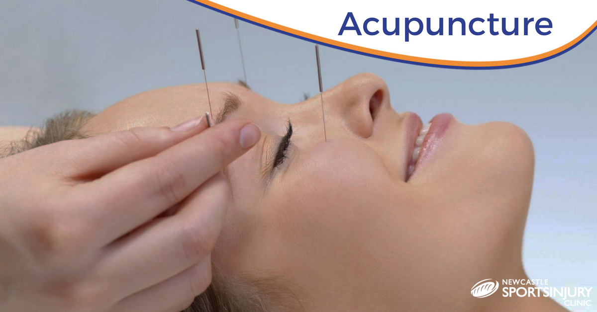 Acupuncture – A Patient’s Perspective – Initial Consultation