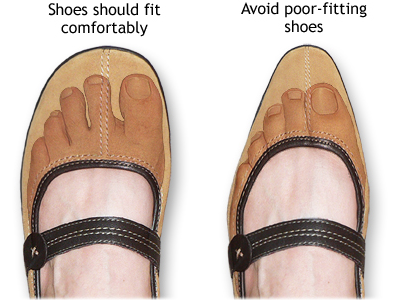 correct fitting shoes